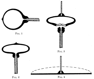 Four stages of making "Crown Glass"